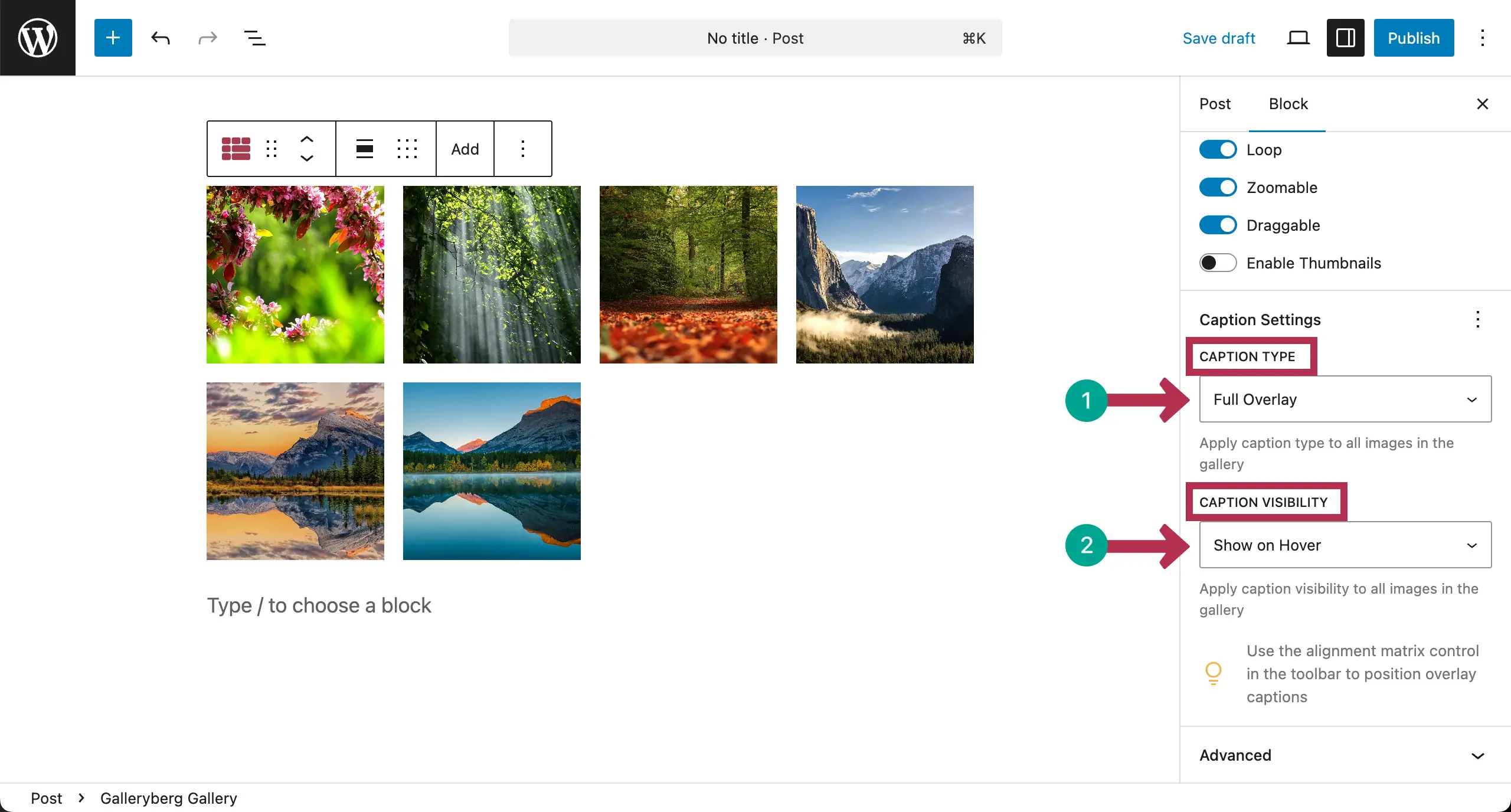 Configure caption type and visibility